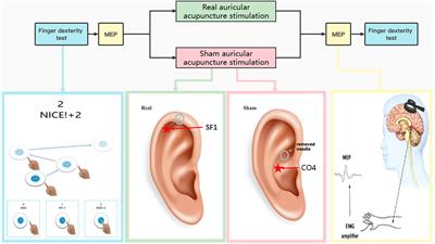 Effects of auricular acupuncture stimulation on healthy adults’ upper limb motor-evoked potentials: A randomized, crossover, double-blind study